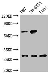 NEUROG2 / NGN2 / Neurogenin 2 Antibody