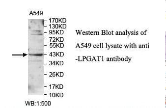 IHC-plus™ Polyclonal Rabbit anti-Human LPGAT1 Antibody (aa49-198, IHC, WB)