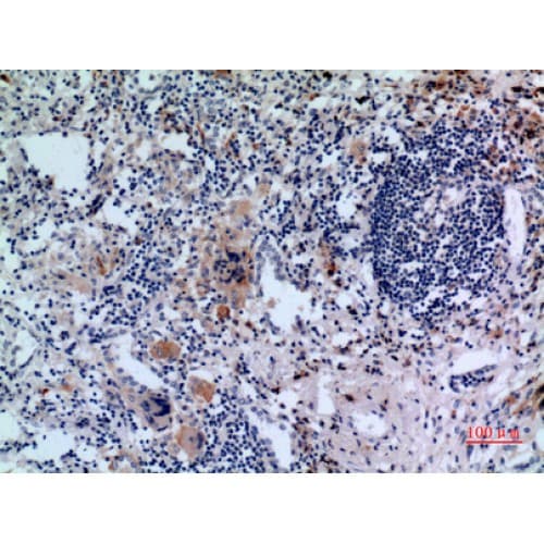 CD71 / Transferrin Receptor Antibody (91-140 aa, N-terminal)