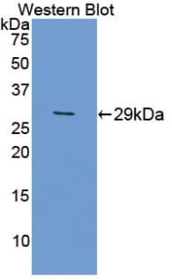PFKP Antibody (aa247-473)