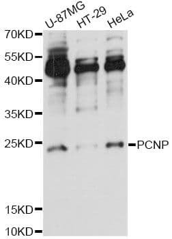 Polyclonal Rabbit anti-Human PCNP Antibody (WB)