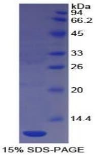 Human PECAM-1 / CD31 Protein (Recombinant His)