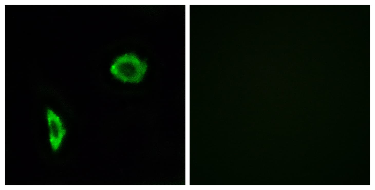 PTGIR / IP Receptor Antibody (aa198-247)
