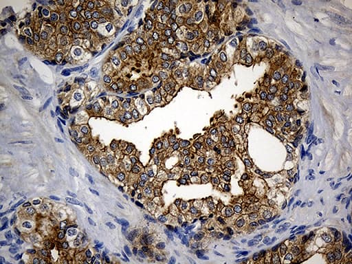 CIB1 / KIP Antibody (aa2-191, clone OTI1B8)
