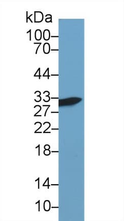 LGALS3 / Galectin 3 Antibody (aa2-264)