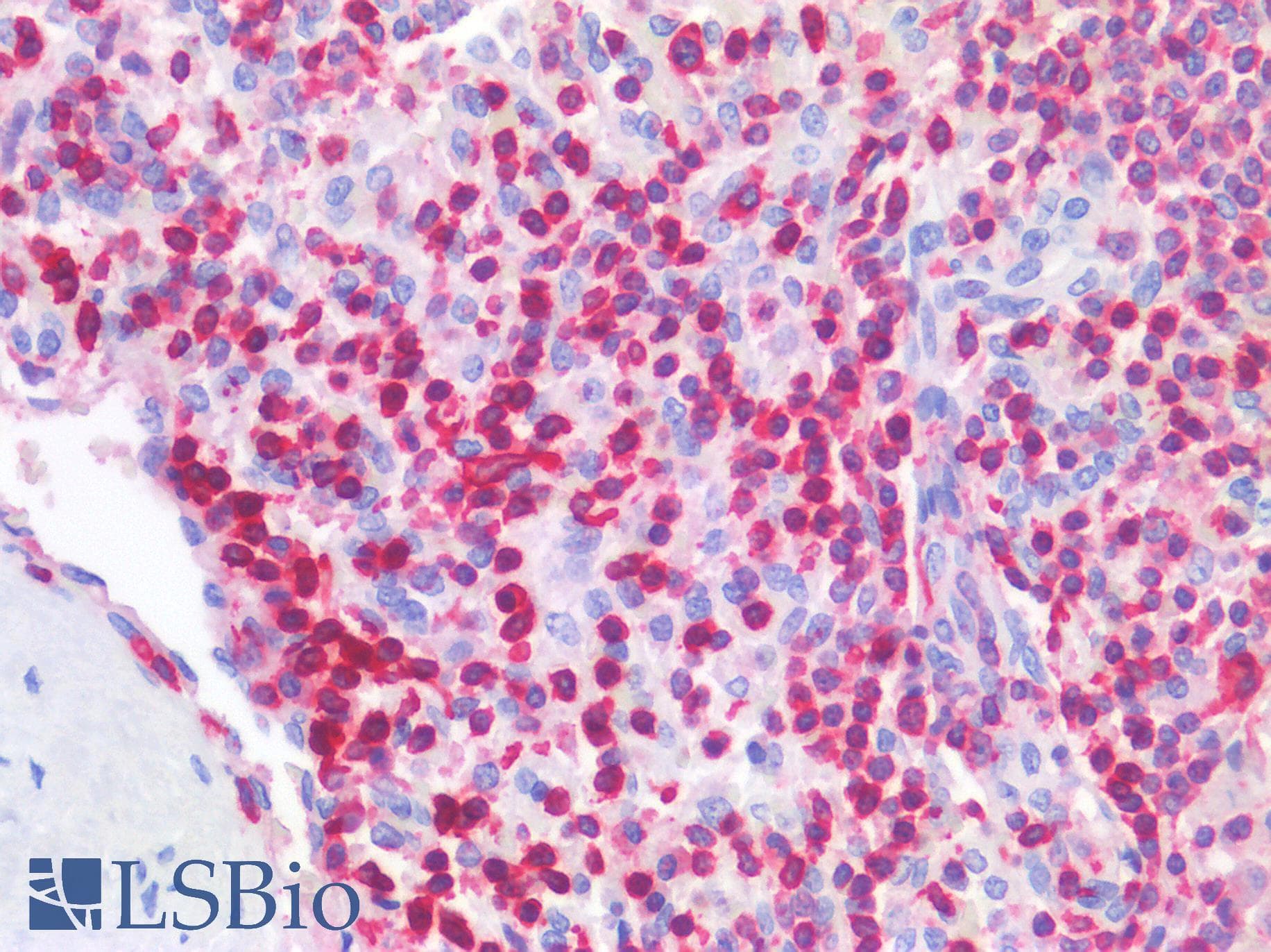 PathPlus™ Polyclonal Rabbit anti-Human LSP1 Antibody (IHC, WB)