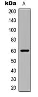 Polyclonal Rabbit anti-Human MAPK15 / ERK7 Antibody (phospho-Thr175/Tyr177, IHC, WB)