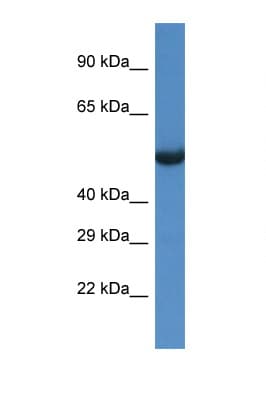 PA26 / SESN1 Antibody (aa375-424)