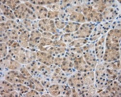 SRR / Serine Racemase Antibody (clone OTI3B5)