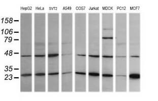 RAB21 Antibody (clone OTI6E12)