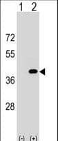 PPP1CC / PP1 Gamma Antibody (aa281-309)