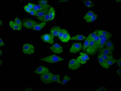 SLC15A4 / PHT1 Antibody
