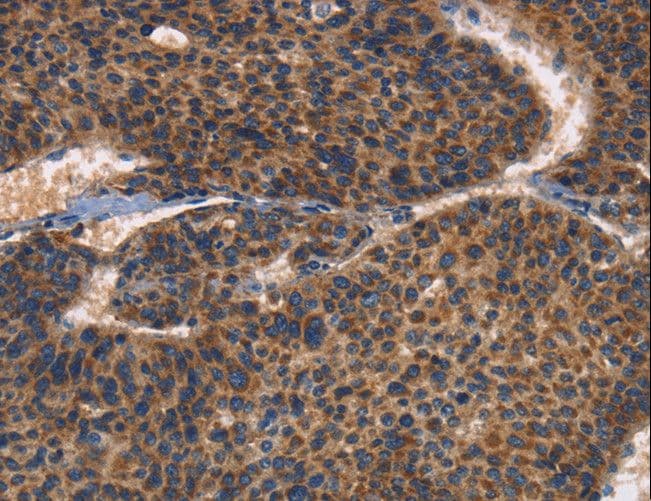 ITGB3 / Integrin Beta 3 / CD61 Antibody