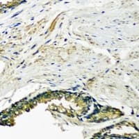 POMGNT1 Antibody