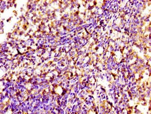 SIPA1 Antibody