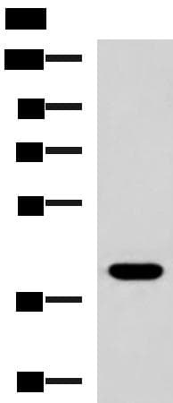 Polyclonal Rabbit anti-Human LPPR5 Antibody (IHC, WB)