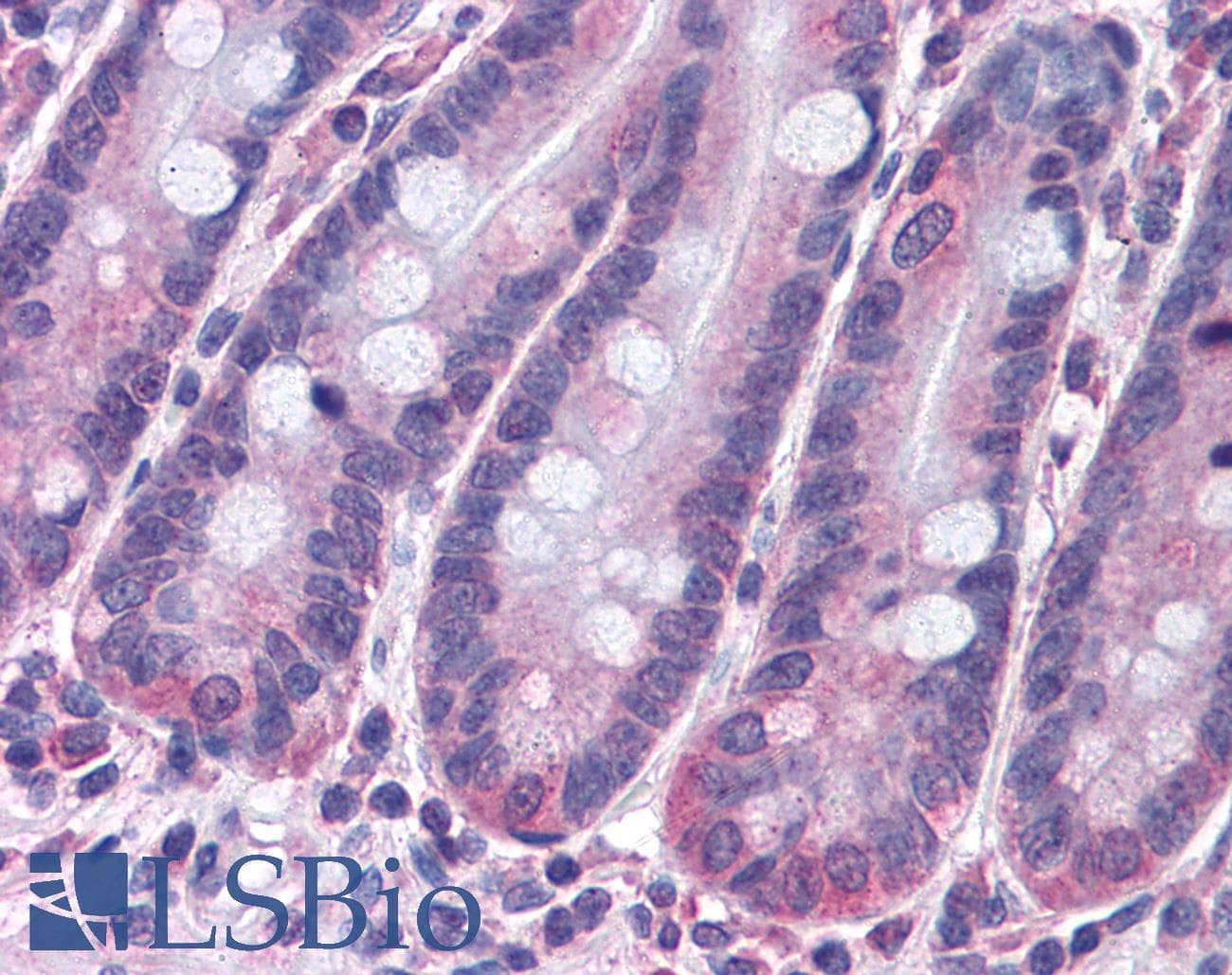 IHC-plus™ STAP2 Antibody (aa436-449)