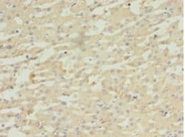 DAPK2 / DAP Kinase 2 Antibody (aa222-370)