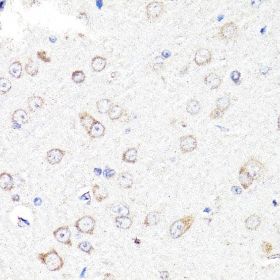 RNF149 Antibody