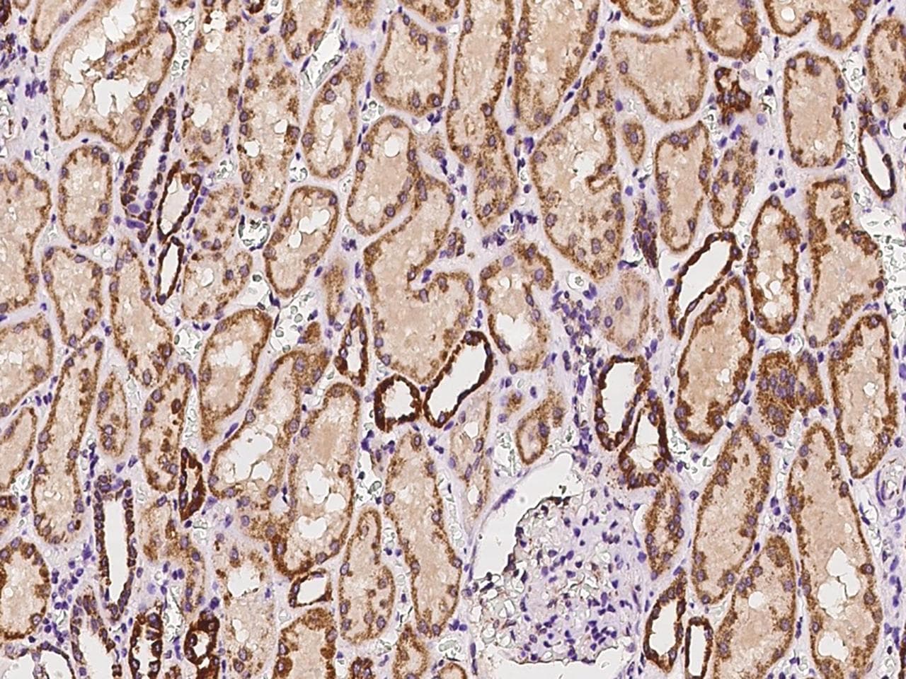 BCKDHA / BCKDE1A Antibody