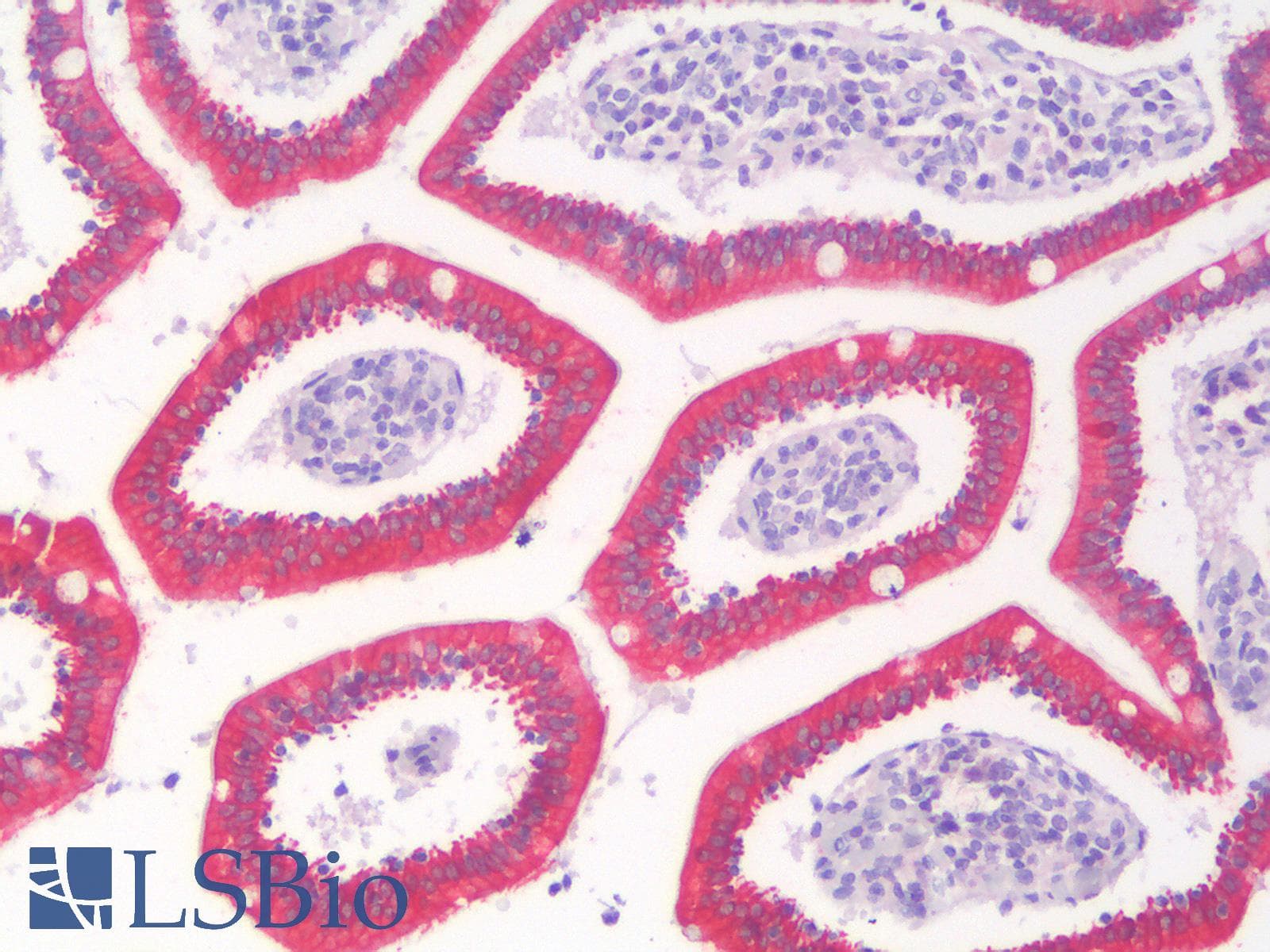 PathPlus™ KRT8 / CK8 / Cytokeratin 8 Antibody