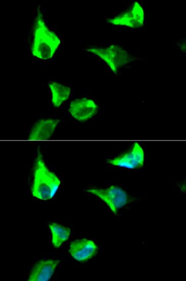 R1 / RRM1 Antibody