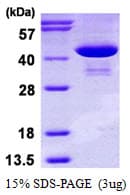 Human PSAT1 Protein (Recombinant His)