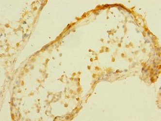 Polyclonal Rabbit anti-Human PALS2 / MPP6 Antibody (IHC)