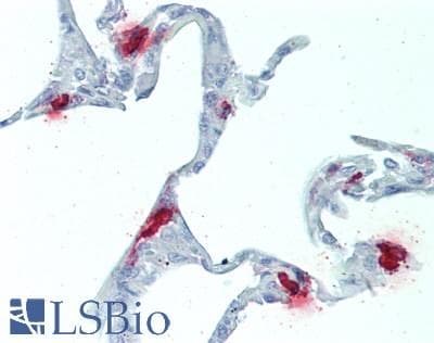 IHC-plus™ Polyclonal Rabbit anti-Human Tpsb2 / Tryptase Beta 2 (Mouse Antibody (IHC)