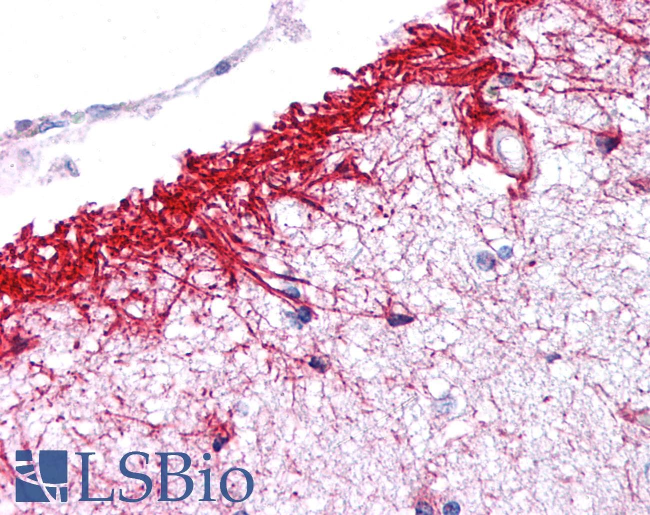 IHC-plus™ Polyclonal Rabbit anti-Human NLRP14 / NALP14 Antibody (IHC, WB)