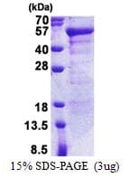 Human JSRP1 Protein (Recombinant His)