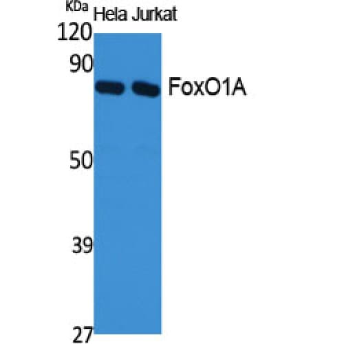 FOXO1 / FKHR Antibody (270-350 aa)