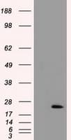 TNNI3 / Cardiac Troponin I Antibody (clone OTI4E5)