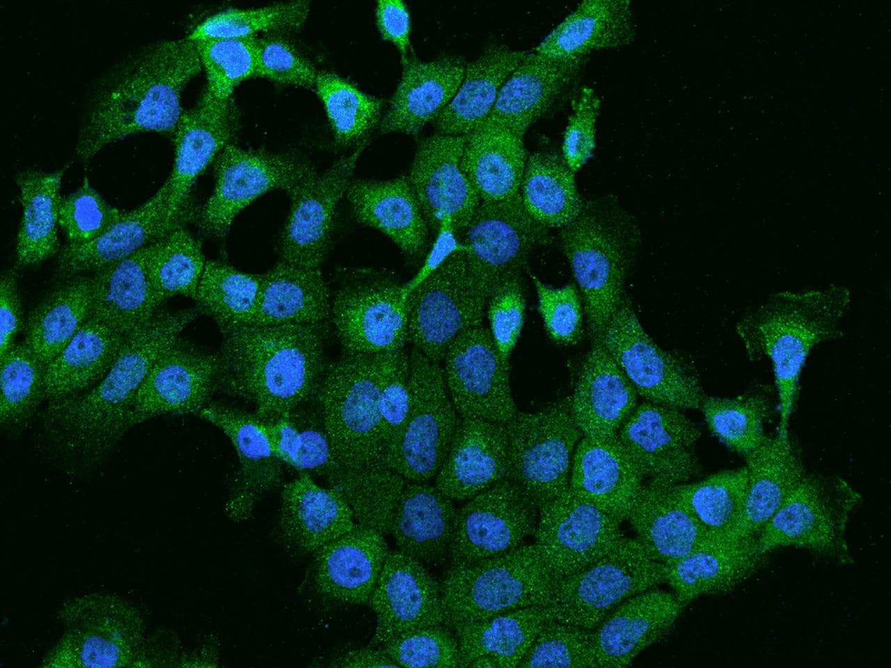 Polyclonal Rabbit anti-Human PI4K2B Antibody (IF)