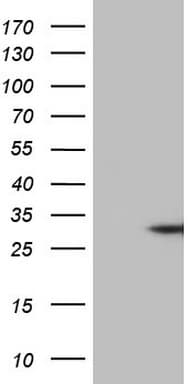 TNF Alpha Antibody (clone OTI3H10)
