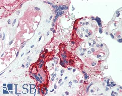 FGF21 Antibody