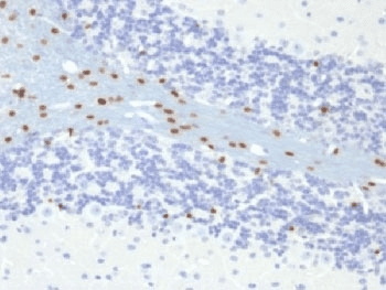 Monoclonal Mouse anti-Human SOX10 Antibody (clone SOX10/991, Ready-to-Use, IHC)