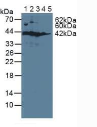 SORD / Sorbitol Dehydrogenase Antibody (aa2-357, Biotin)