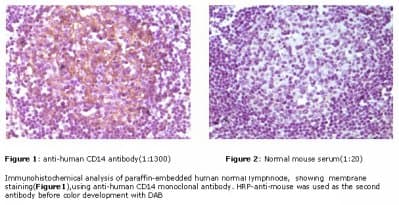 Monoclonal Mouse anti-Human CD14 Antibody (clone 5A3B11B5, IHC)