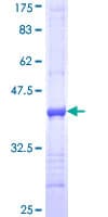Human ITGA7 / Integrin Alpha 7 Protein (Recombinant GST, N-terminus)