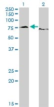 IHC-plus™ Monoclonal Mouse anti-Human EWSR1 / EWS Antibody (clone 5C10, IHC, WB)