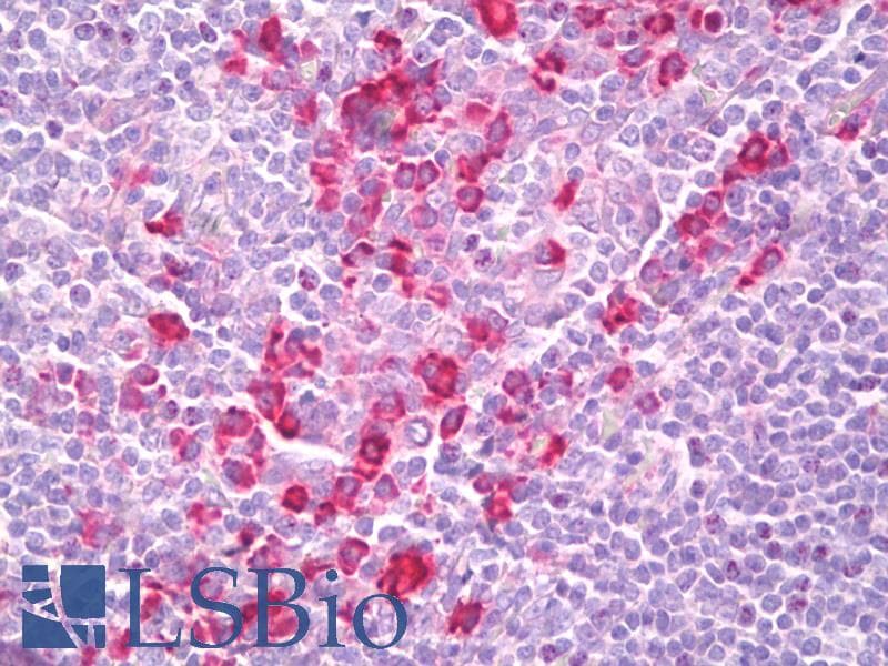 IHC-plus™ Polyclonal Rabbit anti-Human PHACTR2 Antibody (aa169-198, IHC, WB)
