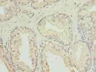 Polyclonal Rabbit anti-Human C20orf11 / TWA1 Antibody (IHC)