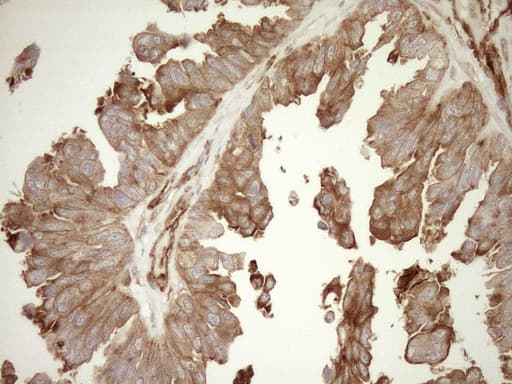 Monoclonal Mouse anti-Human ASPDH Antibody (clone OTI4G8, IHC)