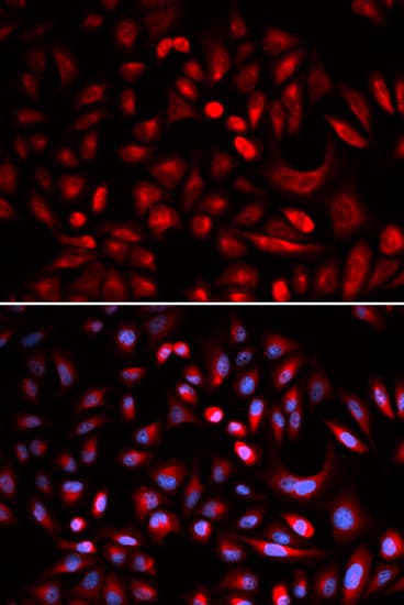Polyclonal Rabbit anti-Human PRKACB Antibody (IHC, IF, WB)