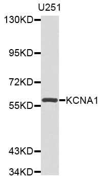 Polyclonal Rabbit anti-Human KCNA1 / Kv1.1 Antibody (IHC, WB)