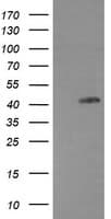 Monoclonal Mouse anti-Human EGFR Antibody (clone OTI2G8, IF, WB)
