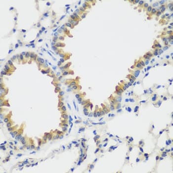 FLT4 / VEGFR3 Antibody