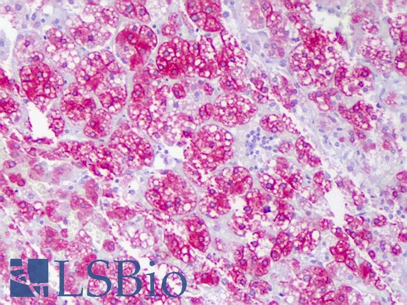 IHC-plus™ ACAT1 Antibody (N-Terminus, clone AT1.H11)