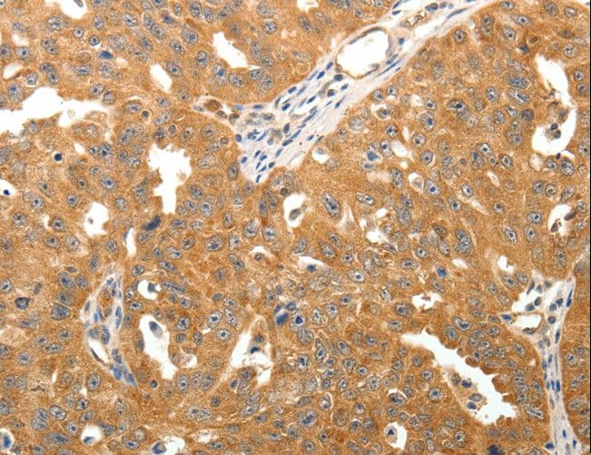 TNN / Tenascin N Antibody